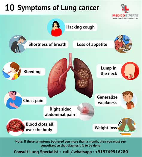 Lung Cancer Signs & Symptoms .